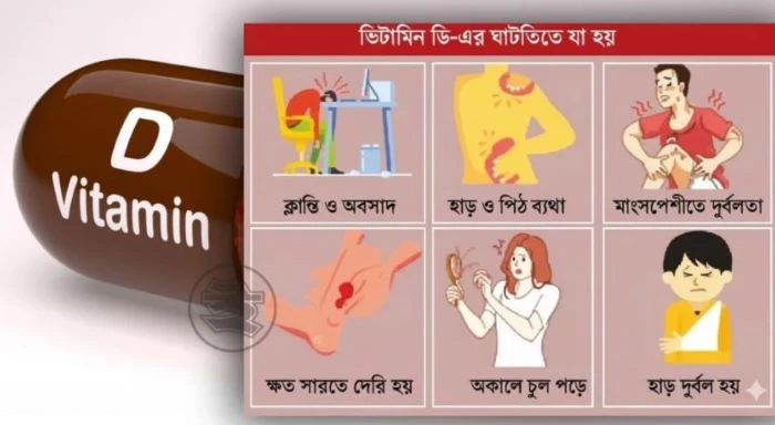 দেশে ভিটামিন ডি-স্বল্পতায় ভুগছেন ৬৭ শতাংশ মানুষ, বড় ঝুঁকি দেখছেন বিশেষজ্ঞরা